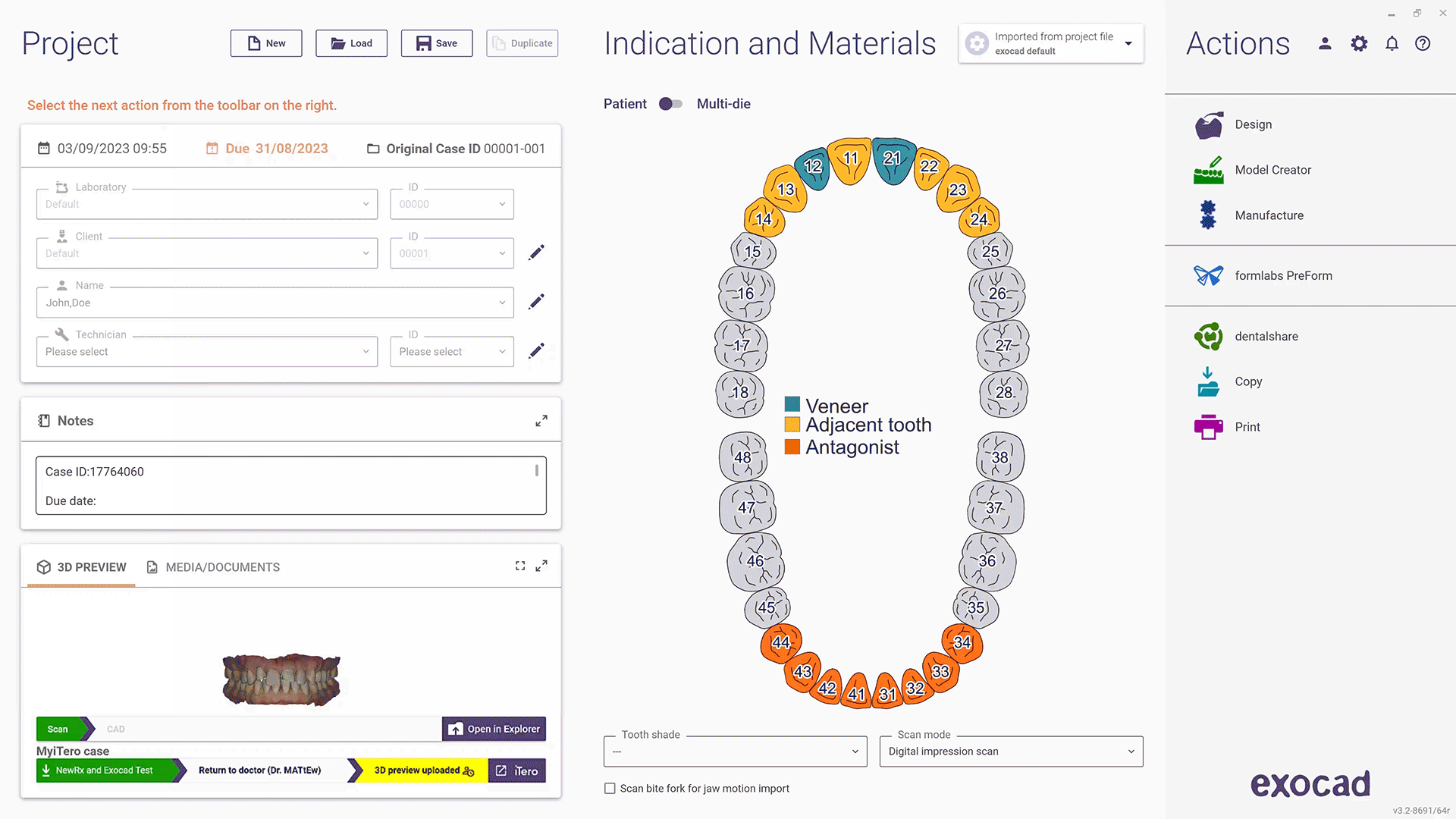 EXOCAD DENTAL CAD